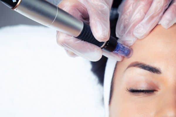 Explaining Total Skin Tightening Treatment and What to Expect 2 What Skin Concerns Can Total Skin Tightening Treatment Help With City of London?